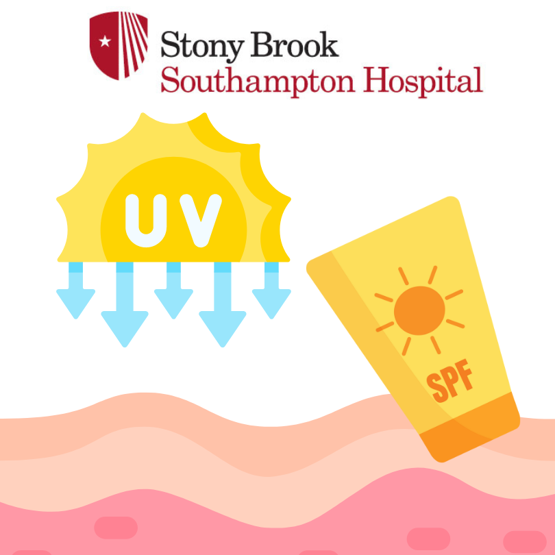 Stony Brook Southampton Hospital: Sun Vs Your Skin Update